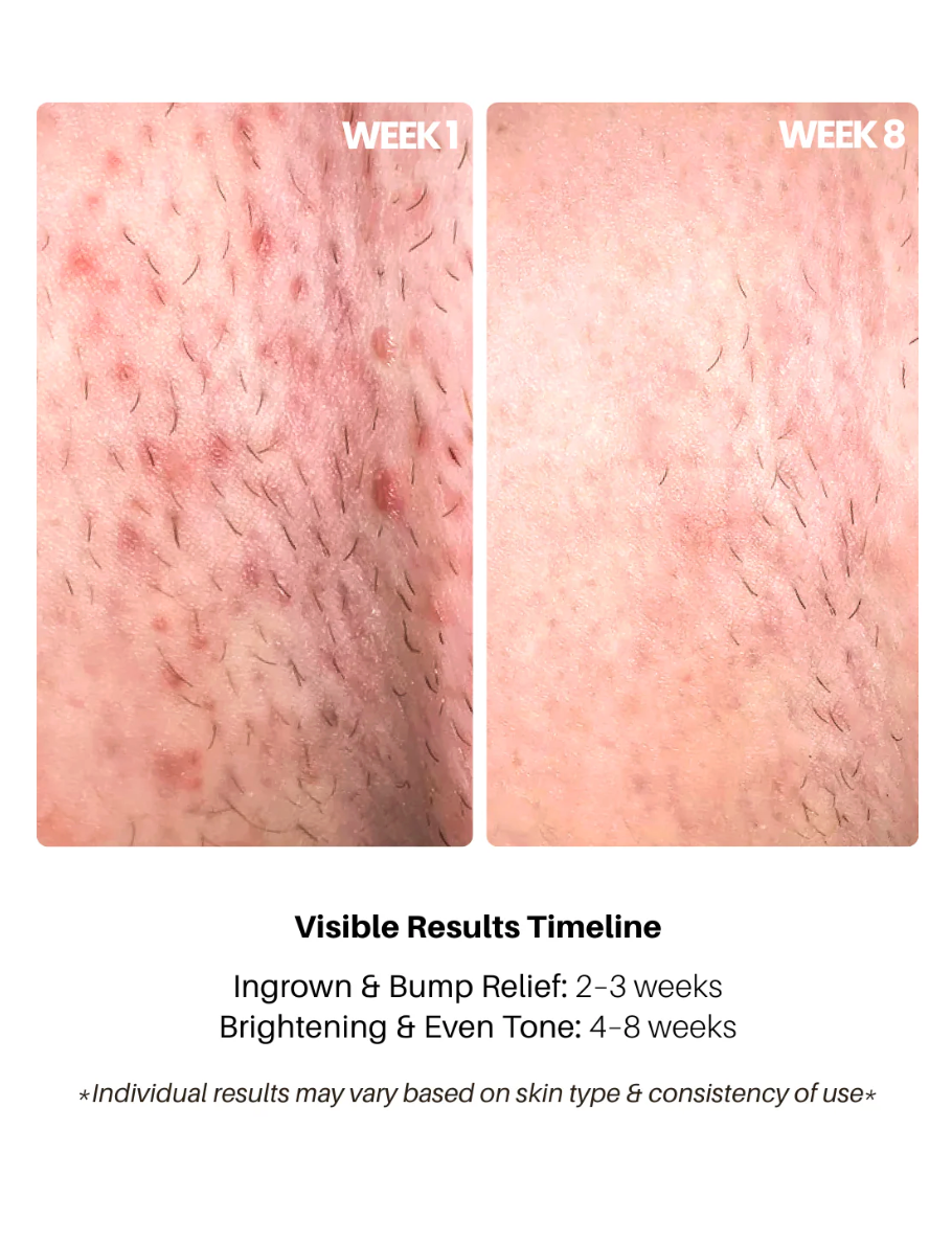 Bright Bikini Line Serum